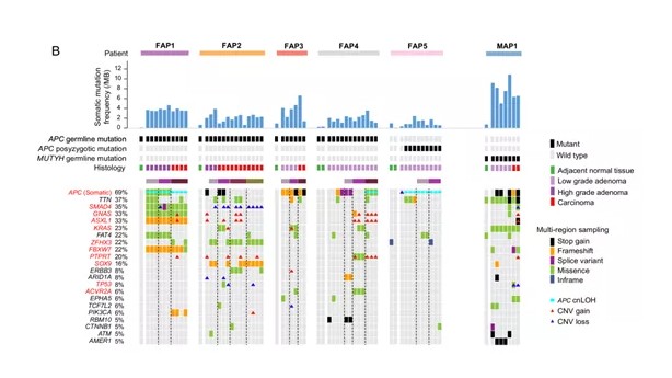 【科研学术】家族性腺瘤性息肉病患者癌变的基因组和转录组分析