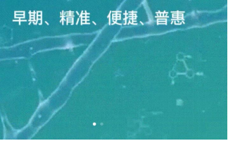 什么样结直肠癌检测试剂机构比较好? 什么样结直肠癌检测试剂机构比较好?
