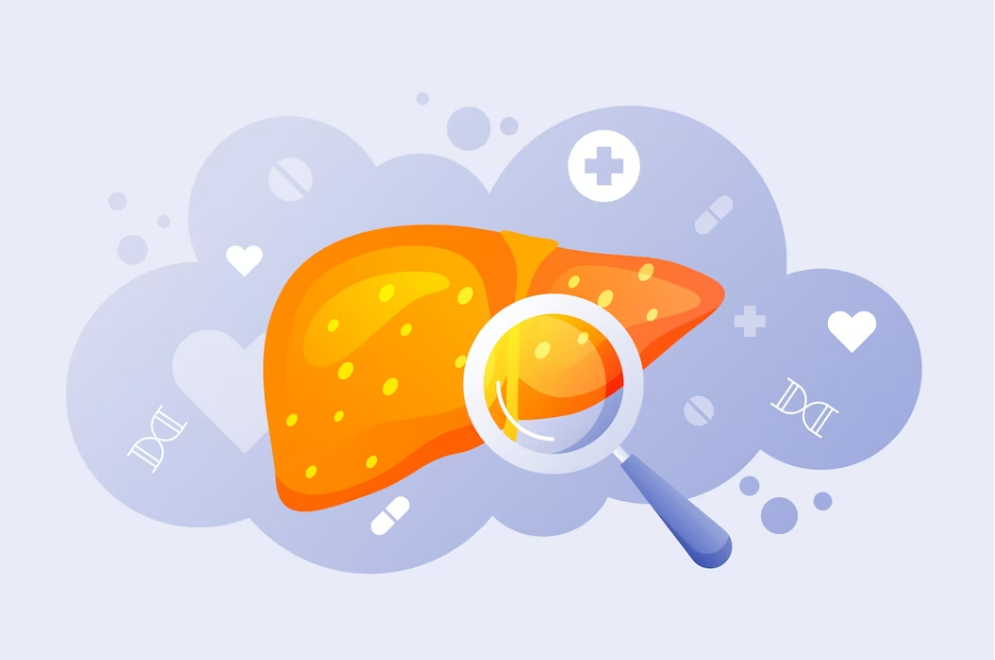 “沉默杀手”——肝癌，其实可以早期发现并干预