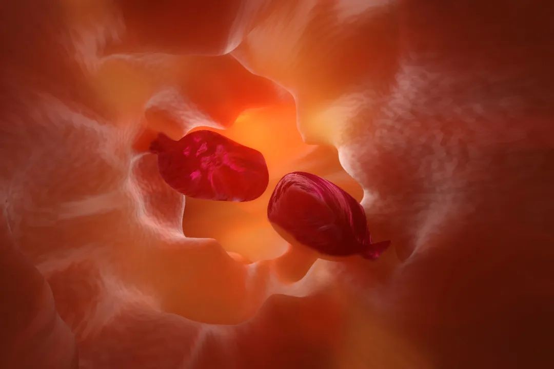 什么样的肠息肉要特别当心？