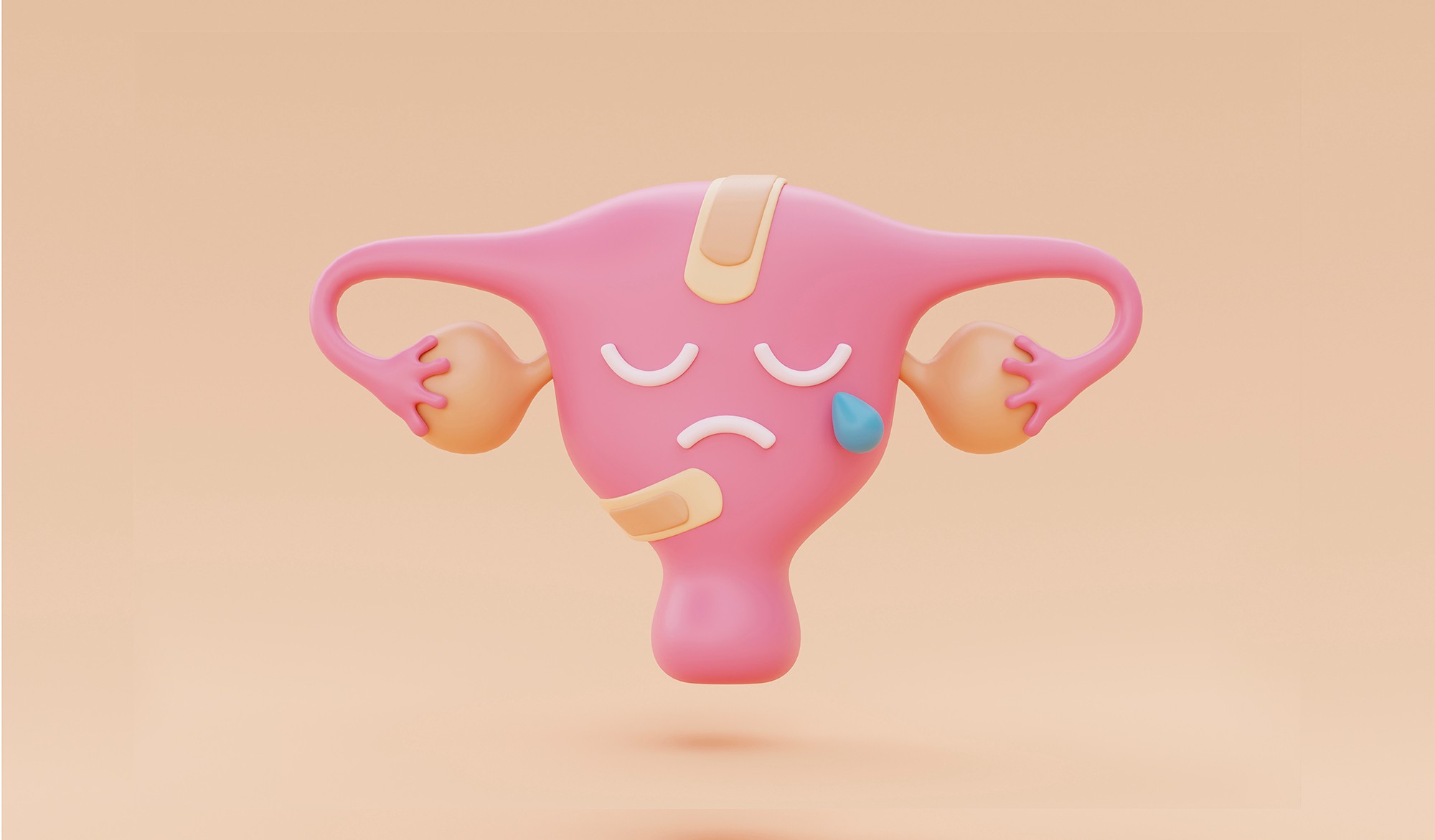 科普 | 全面认识子宫内膜癌